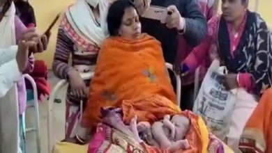 Photo of महिला ने चार हाथ-पैर वाले बच्चे को दिया जन्म, देख लोगों के उड़े होश