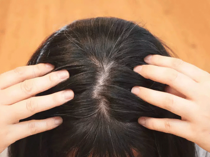 Photo of सफ़ेद बालों की परेशान को दूर करने के लिए आज अपनाए ये पांच उपाय