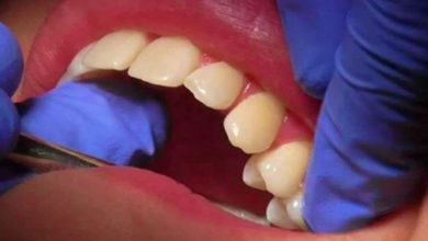 Photo of OMG! 10 साल के बच्चे के मुंह में थे 50 दांत, डॉक्टर भी देखकर हो गए हैरान