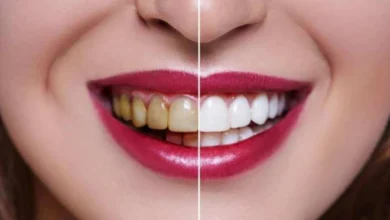 Photo of दांतों के पीलेपन को नेचुरली खत्म करना है तो खाएं फ्रूट्स…
