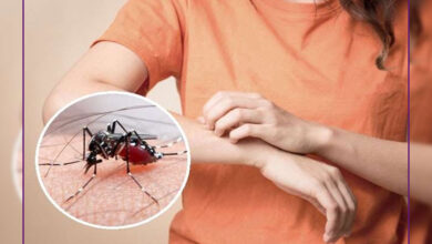 Photo of इन घरेलू नुस्खों से करें मच्छरों के काटने का इलाज, जानें?