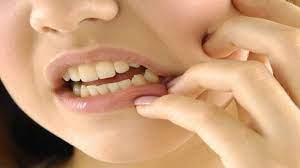 Photo of मुंह में होने वाले छालों के कई कारण हो सकते हैं और राहत पाने के लिए आप एक आसान से उपाय को आजमाएं