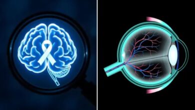 Photo of क्या आंखों की जांच से सालों पहले लग सकेगा अल्जाइमर का पता?
