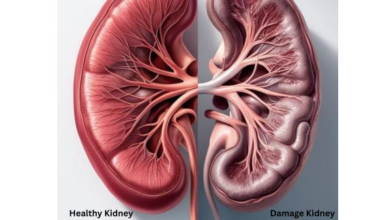 Photo of दोनों किडनी खराब होने के क्या संकेत हैं? जानिए Kidney Failure के शुरुआती लक्षण और बचाव के जरूरी उपाय